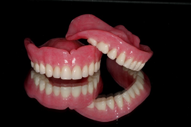 Complete Dentures