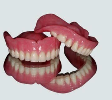 Tooth Replacement Implant